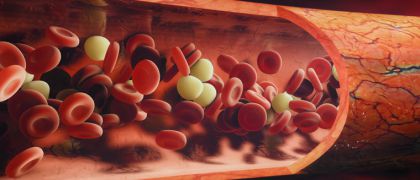 Anemia (niedokrwistość)